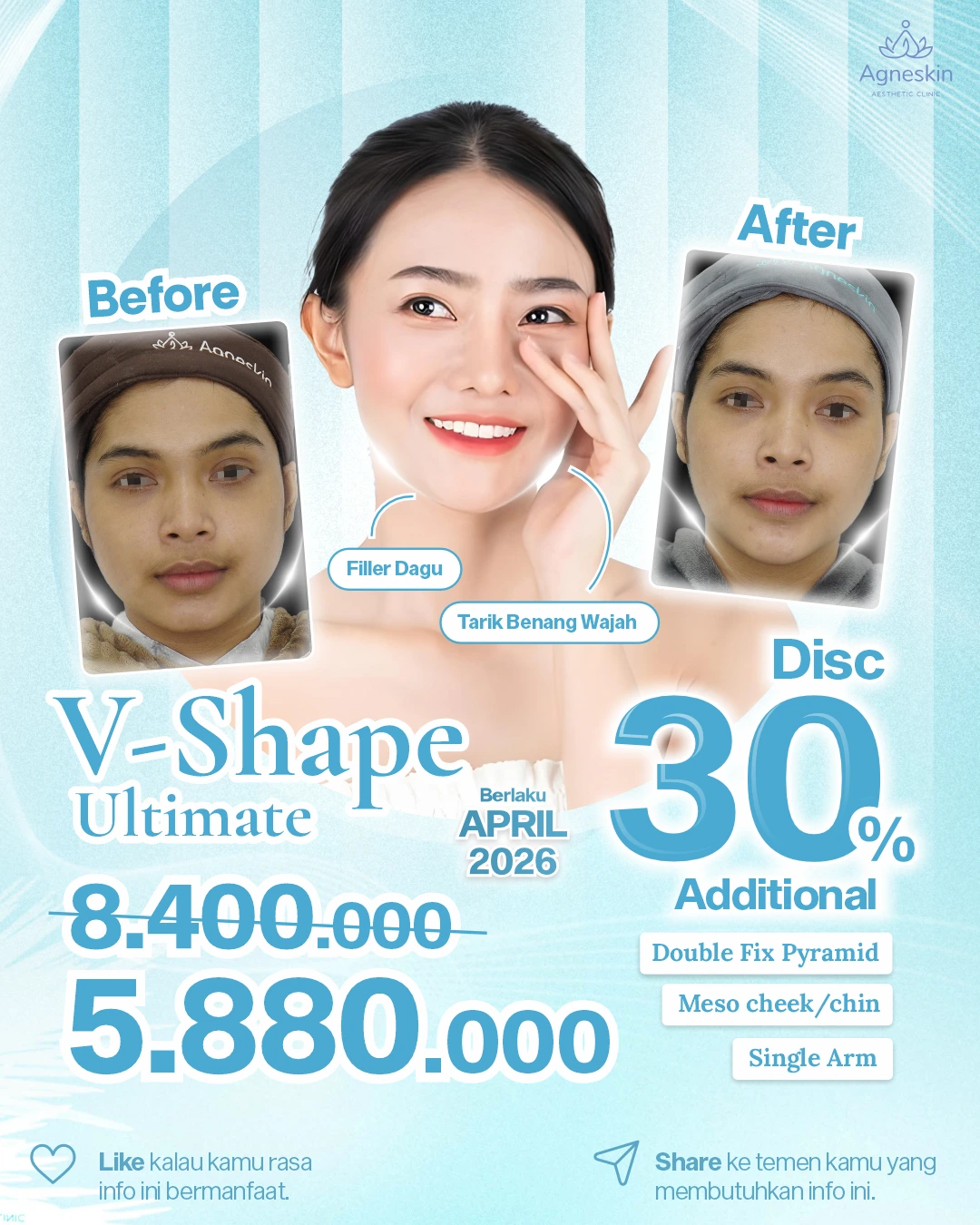 Promo V-Shape Ultimate